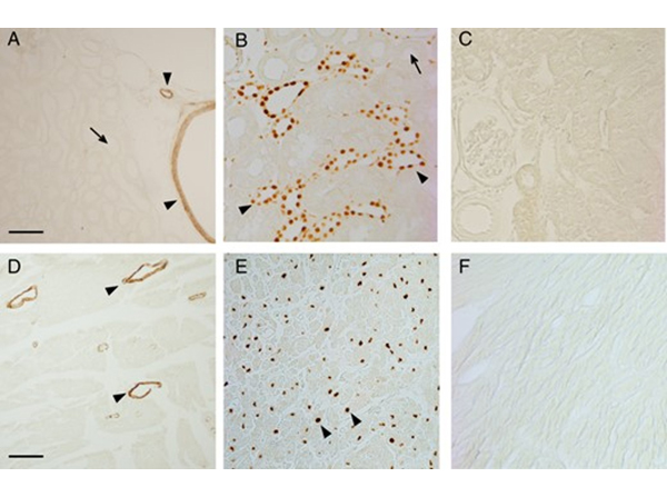 Immunohistochemistry using HSP90 K294ac